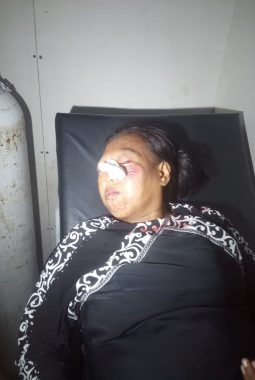 Kecelakaan Tunggal di Jalan Wadas Lemah Abang, Karawang: Baju Tersangkut jari-jari Motor, Ibu dan Balita Terjatuh